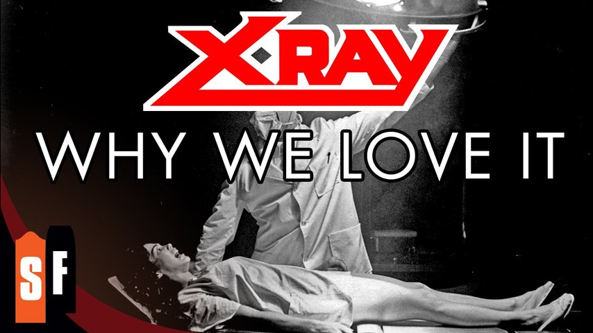 X-Ray - Why We Love It